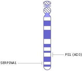 хромосома 14, гены генетические заболевания