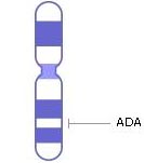 хромосома 20, гены, генетическое заболевание