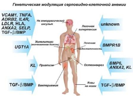 генетика, серповидно-клеточная анемия, 11 хромосома, анемии, эритроциты