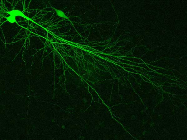 нейрон, гиппокамп, снимок